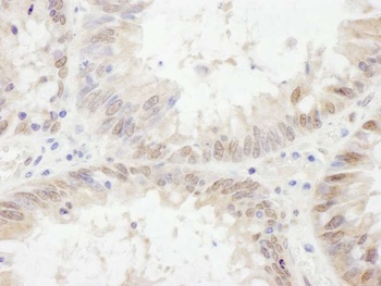 Rabbit ETV6 Antibody