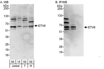 Rabbit ETV6 Antibody