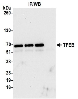 TFEB Antibody