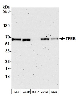 TFEB Antibody