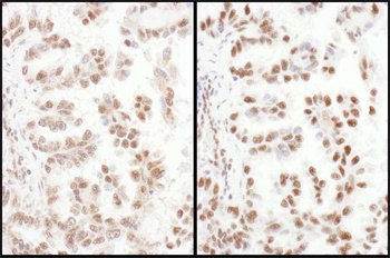 SRp75 Antibody