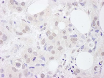 Rabbit anti-U2AF65 Antibody