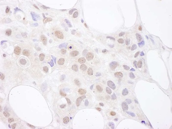 Rabbit anti-U2AF65 Antibody