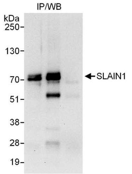 Rabbit SLAIN1 Antibody
