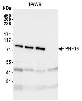 PHF16 Antibody