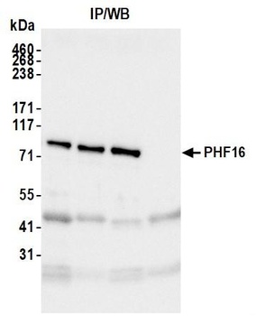 Rabbit anti-PHF16 Antibody