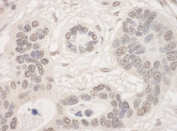 Rabbit anti-THOC2 Antibody
