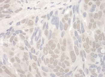Rabbit anti-THOC2 Antibody