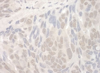 THOC2 Antibody