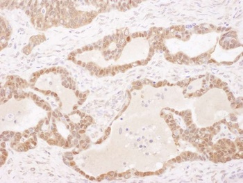 Rabbit anti-GSTP1 Antibody