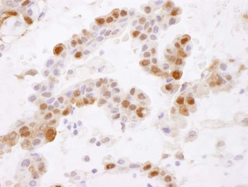 Rabbit anti-GSTP1 Antibody