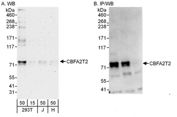 Rabbit CBFA2T2 Antibody