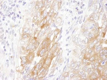 Rabbit anti-LIN28B Antibody