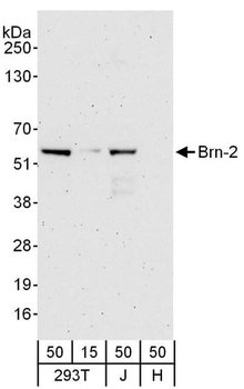 Rabbit Brn-2 Antibody