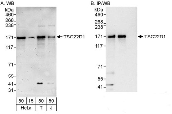 Rabbit TSC22D1 Antibody