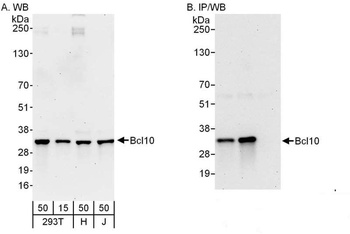 Rabbit Bcl10 Antibody