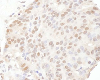 TRPS1 Antibody