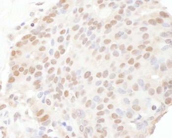 Rabbit anti-TRPS1 Antibody
