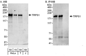 Rabbit anti-TRPS1 Antibody