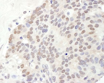 TRPS1 Antibody