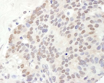 Rabbit anti-TRPS1 Antibody
