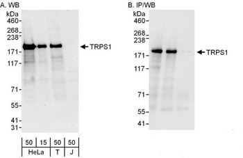 Rabbit anti-TRPS1 Antibody