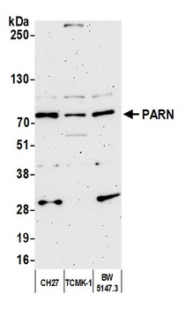 Rabbit anti-PARN Antibody