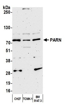 PARN Antibody