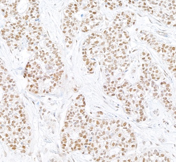 Rabbit anti-PARN Antibody