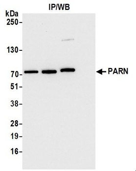 PARN Antibody
