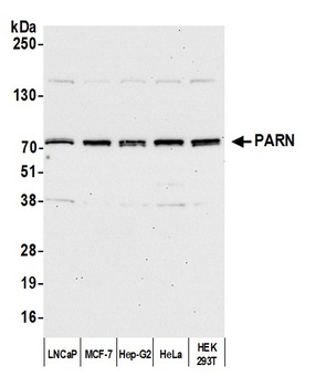 Rabbit anti-PARN Antibody