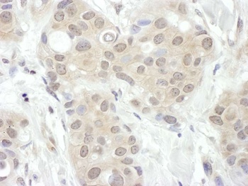 Rabbit anti-FIH-1 Antibody