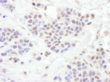 Rabbit TLE1 Antibody