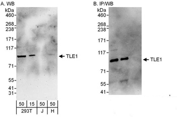 Rabbit TLE1 Antibody