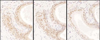 Rabbit anti-USF2 Antibody