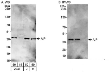 Rabbit anti-AIP Antibody