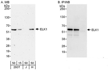 Rabbit ELK1 Antibody
