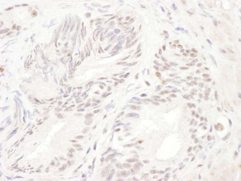 Rabbit anti-ELK1 Antibody