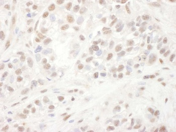 Rabbit anti-ELK1 Antibody