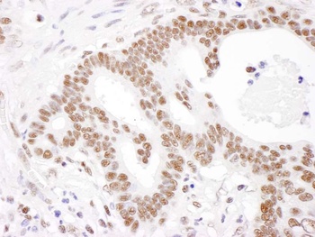 Rabbit anti-PABPN1 Antibody
