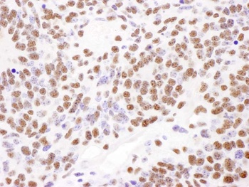 Rabbit anti-PABPN1 Antibody