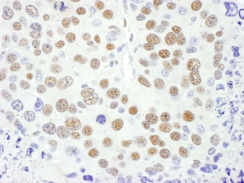 Rabbit anti-MEF2D Antibody