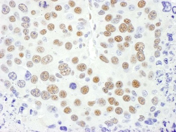 MEF2D Antibody