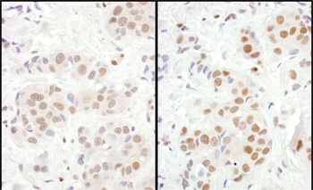Rabbit anti-MEF2D Antibody