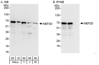 Rabbit anti-MEF2D Antibody