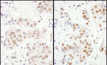 MEF2D Antibody