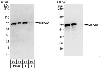 Rabbit anti-MEF2D Antibody