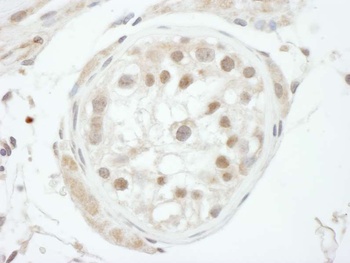 Rabbit anti-GTF2H1 Antibody