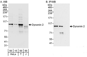 Rabbit Dynamin 2 Antibody