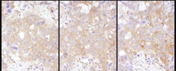 Rabbit anti-STAT2 Antibody